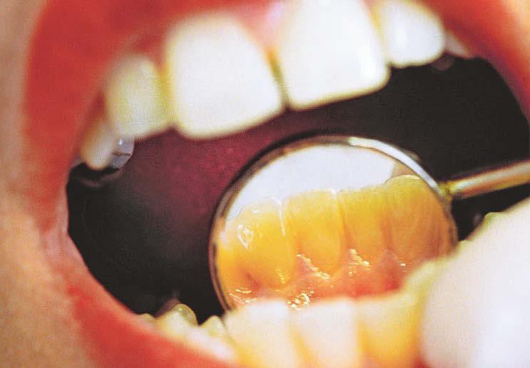 Six more dental practices to end their NHS contracts