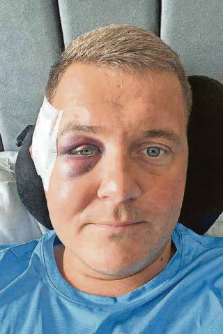 'I could have easily been decapitated'