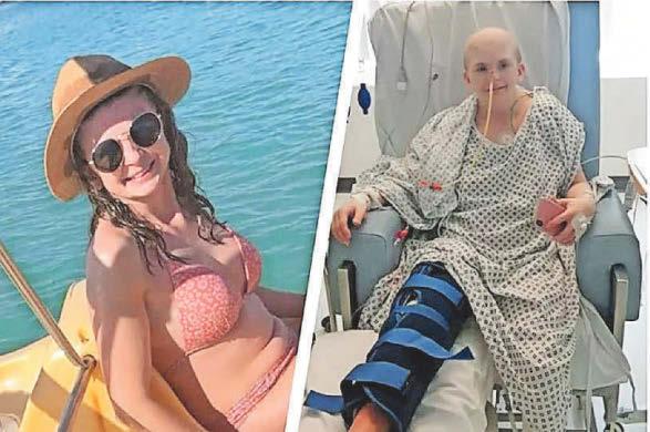 I broke my leg ...then was told that I had bone cancer