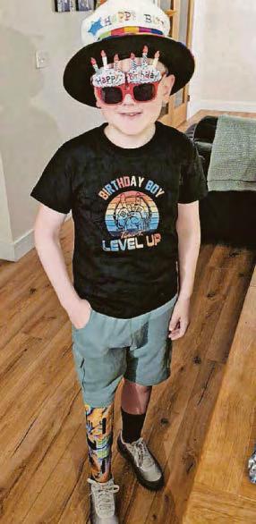 YOUNG BOY DIAGNOSED WITH 'GROWING PAINS' HAD CANCER