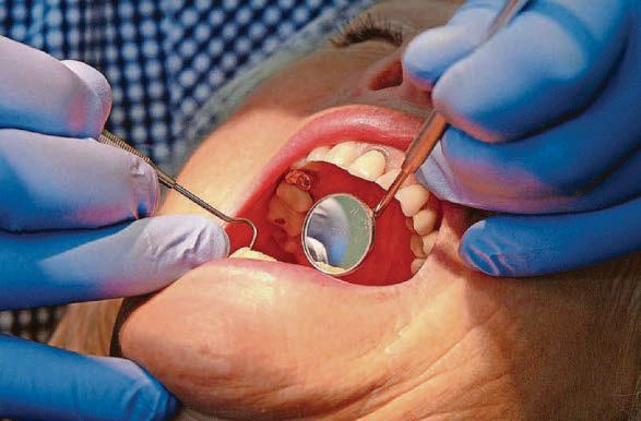 'EXODUS' WARNING OVER DENTAL PLAN