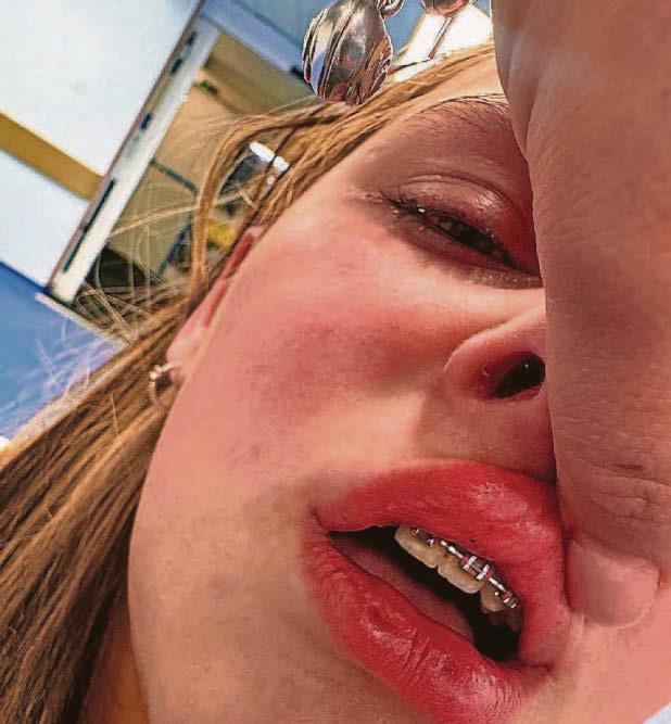 Schoolgirl is 'hunted' and beaten by a teenage gang