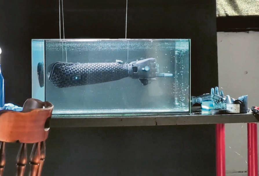 Bionic arm 'pushes the boundaries of what's possible'