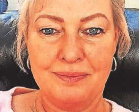 Grandma died from rabies after stray dog scratch