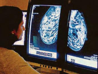 UK's 'shockingly low breast testing uptake