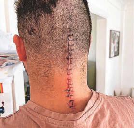 Dad transforms his life after brain surgery