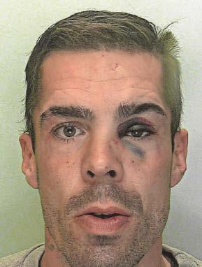 Violent thug bit fellow bus passenger's face