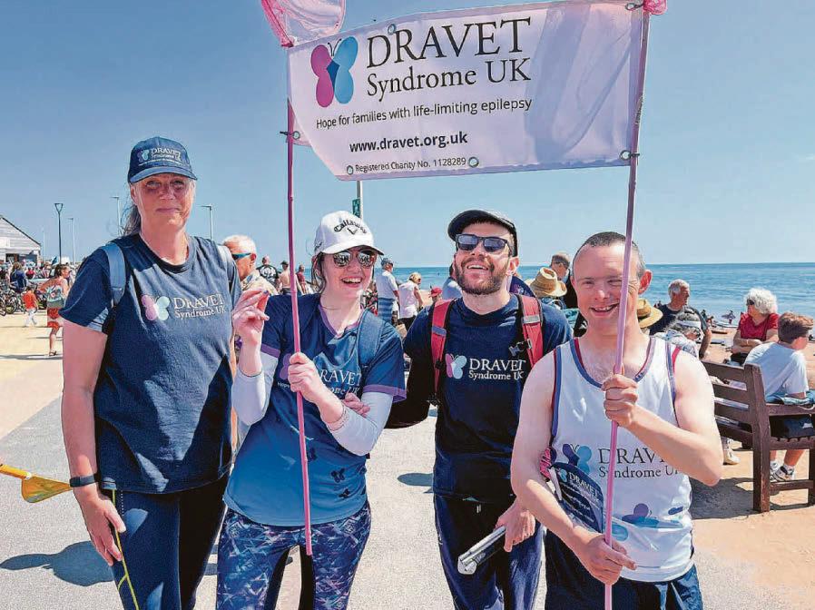 Woman with rare condition takes on charity challenge to help others