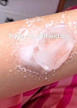 Warning over salt and ice challenge