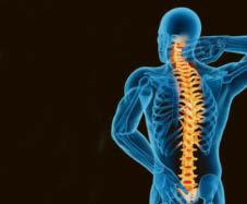 Better Bones campaign hits 100,000 milestone