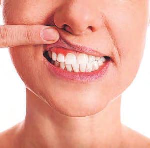 Save your smile