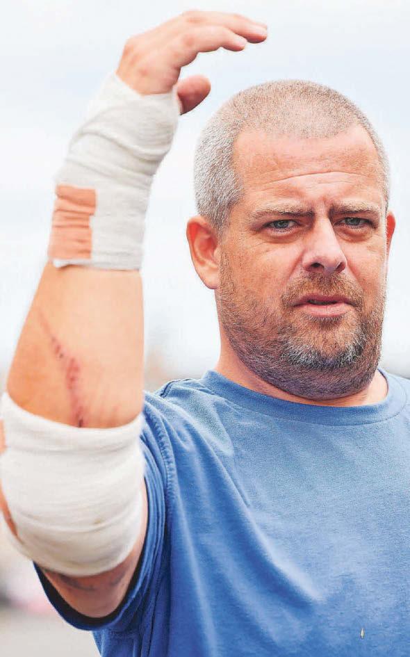 Man had to 'rip his hand' from powerful dog's mouth after feeding it