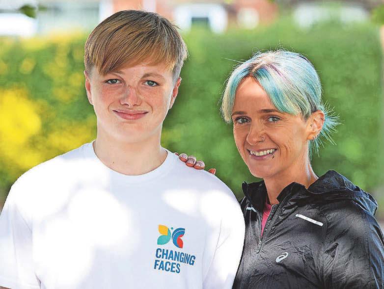 'Remarkable' Charlie is an inspiration for others