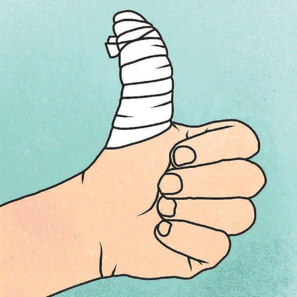 What help is at hand for my sprained thumb?