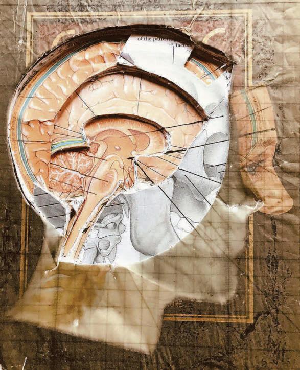 Neurodiversity as golden