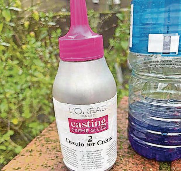 'Taken to hospital then transferred to burns unit'