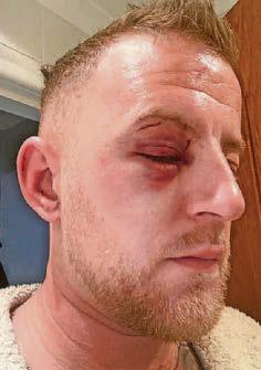 'Teenage gang attacked us as we went home'