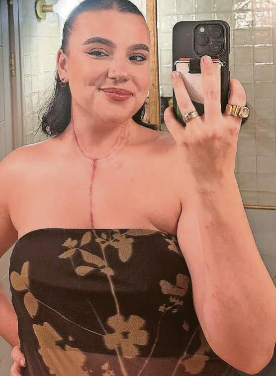 They took out 200 cancerous lumps - but I'm proud of my scars