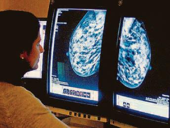 UK's 'shockingly low' breast testing uptake