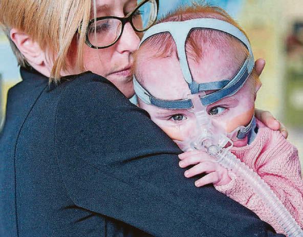 Pioneering op for girl born with heart outside of her body