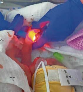 Parents of battling baby Chloe raising cash for the QMC neo-natal unit