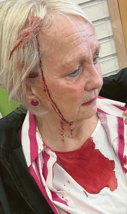 Caution advised after Jane is 'attacked by protective crow'