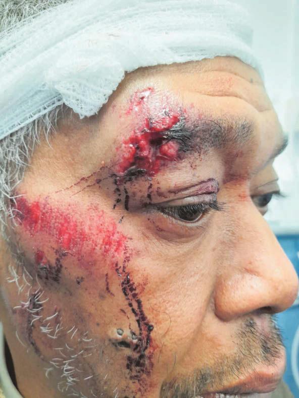 'I don't want to see the boys sent to prison... I want them rehabilitated'