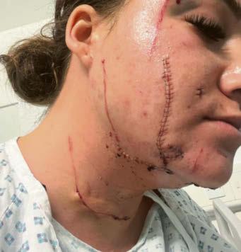 'Monster' ex hid in bushes and slashed my throat and face... he's taken everything from me