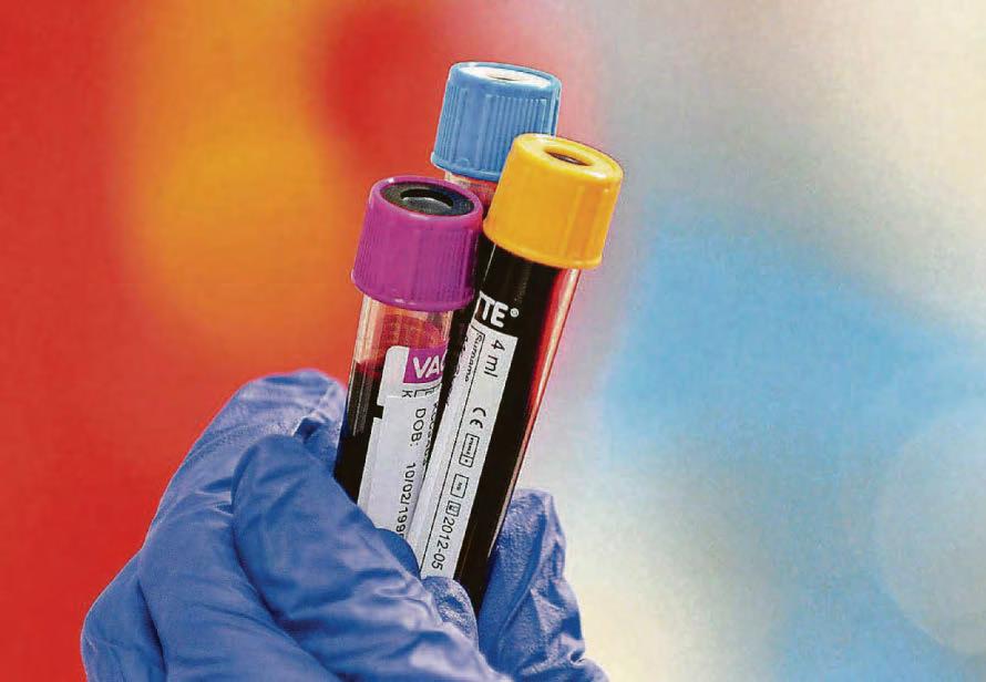 Blood test offers hope of detecting Alzheimer's in patients quicker and easier