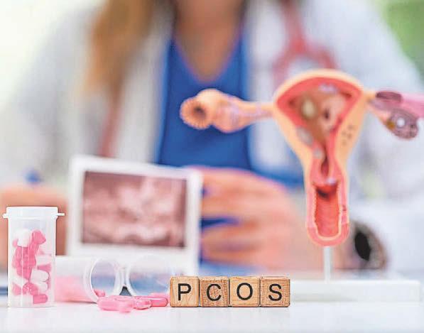 The early signs of PCOS that are often overlooked
