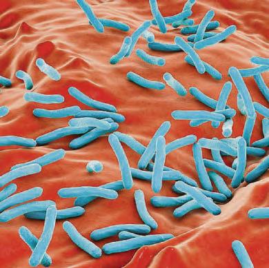 HSE warn of tuberculosis cough risk