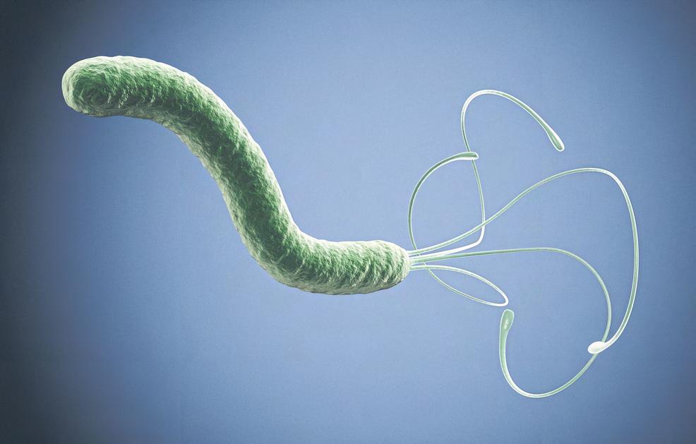 H. pylori infection can cause ulcers