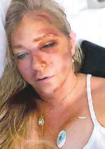 Andrew accuser 'on brink of death'