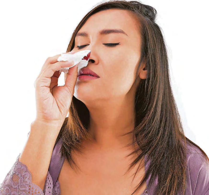 How do I stop my out-of-the-blue nosebleeds?