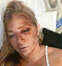 Cops deny Giuffre’s ‘injuries’