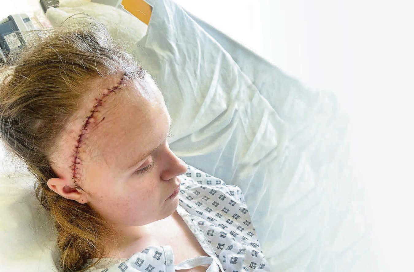 'Docs cut off part of my skull and stored it in my stomach'