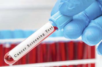 Scots waiting on access to revolutionary cancer test