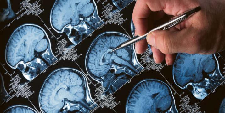 'We risk dementia sufferers missing out on big breakthroughs'