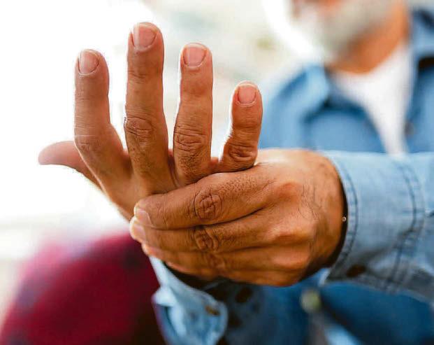 Huge toll of arthritis in Scotland is spelled out