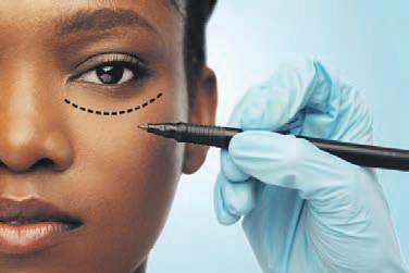 The truth about cosmetic surgery scars
