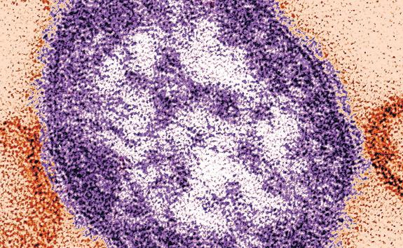 US Measles Outbreak Spreads as RFK Repeats False Claims on Jab