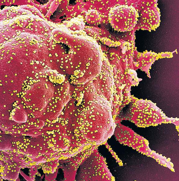 Health experts highlight the lethal bacteria and viruses that may cause next pandemic