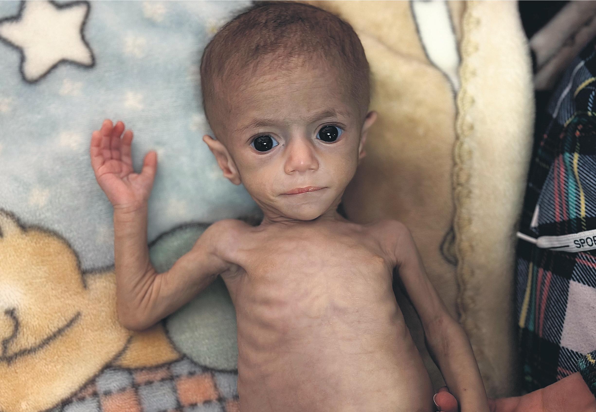 'Absolute cruelty' The baby girl who has come to symbolise Gaza's pain