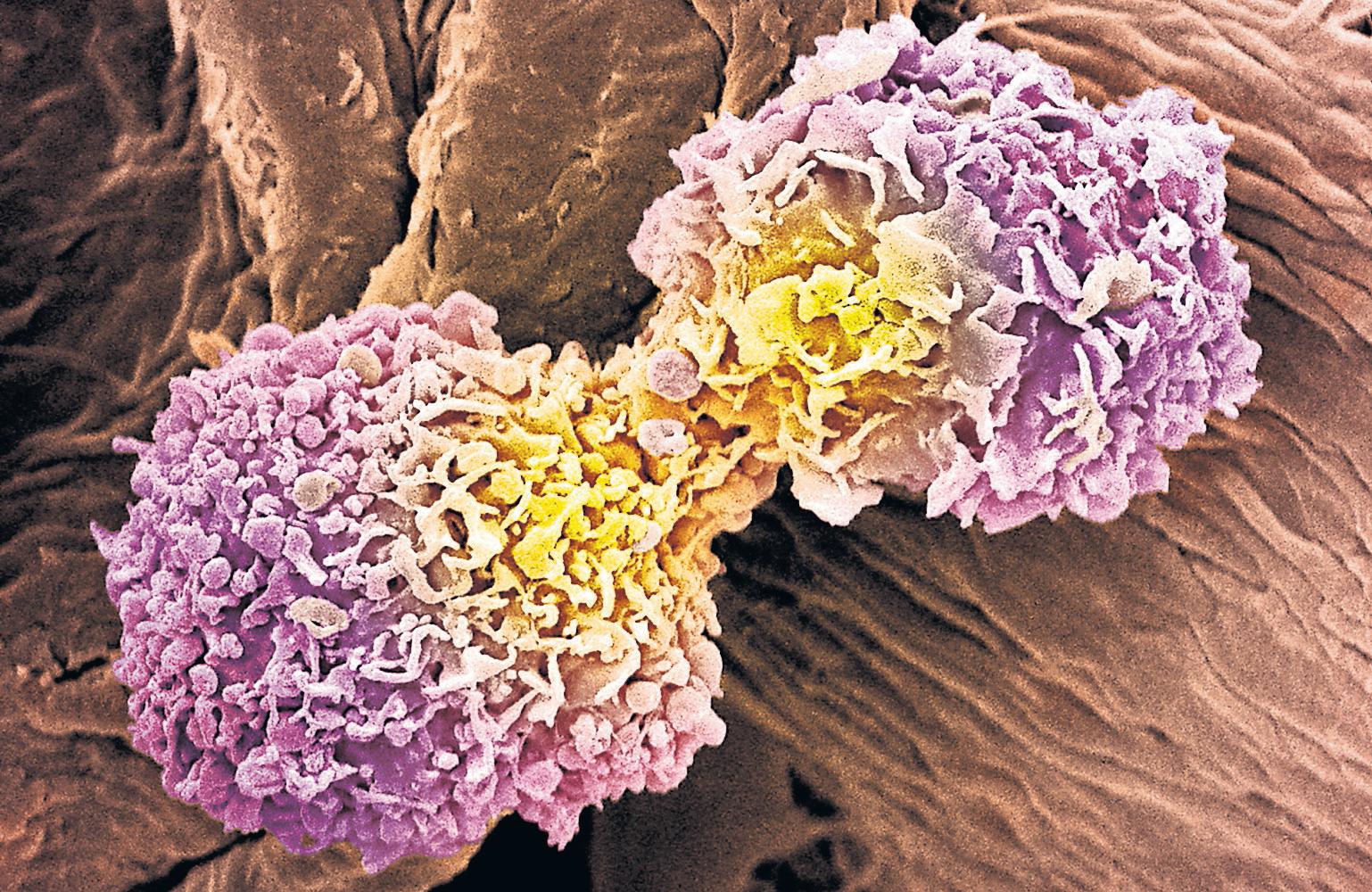 DNA blood test to bring 'new era' of personalised cancer care in England