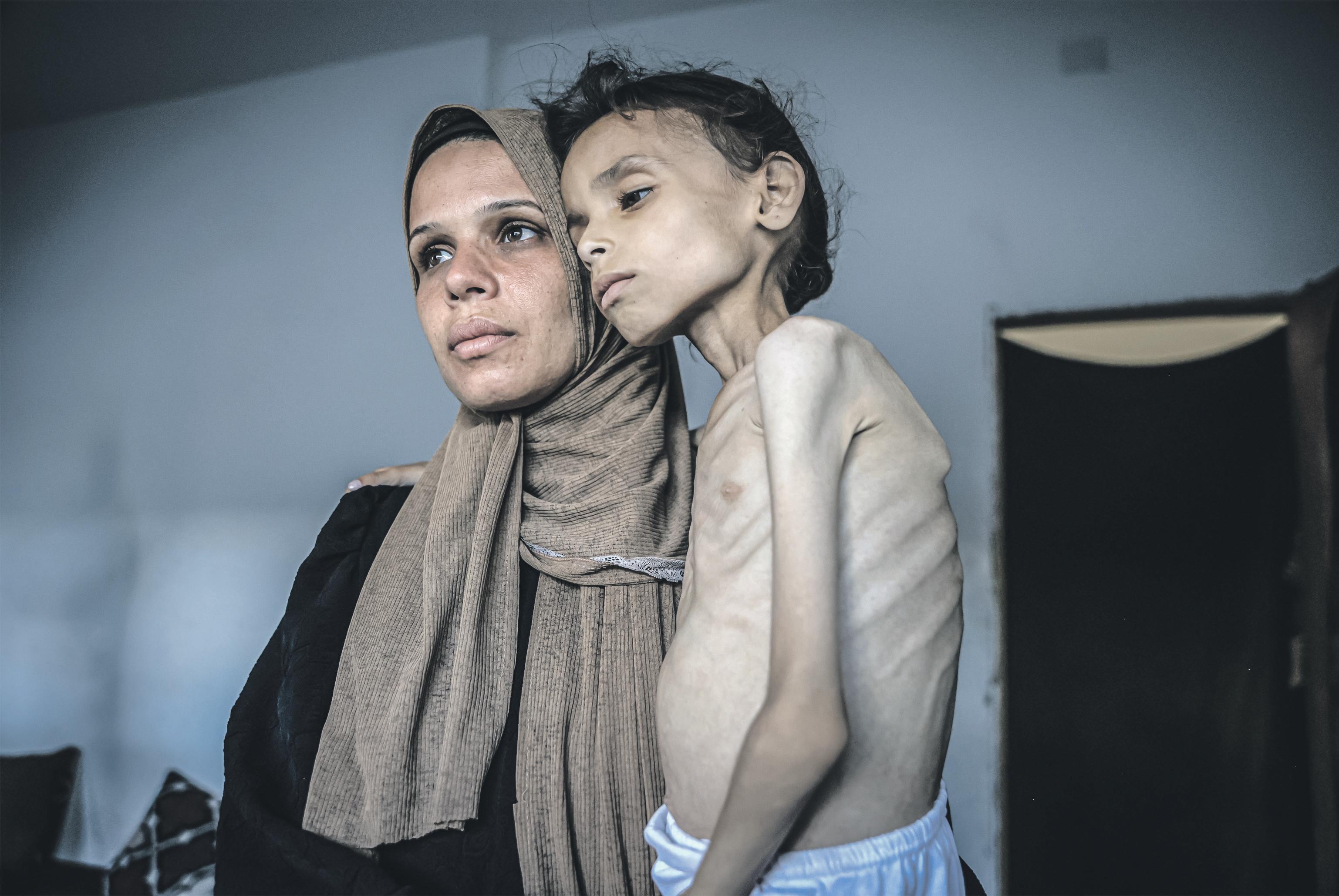 'We are dying slowly' Palestinians powerless as their children starve
