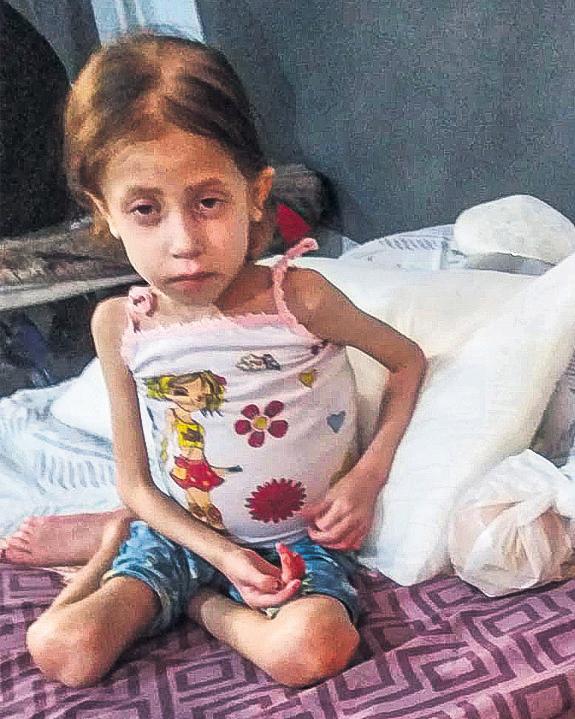 Medical evacuation Jana, eight, on brink of death in wait for Israel to approve her transfer from Gaza
