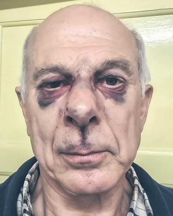 'A very English war'