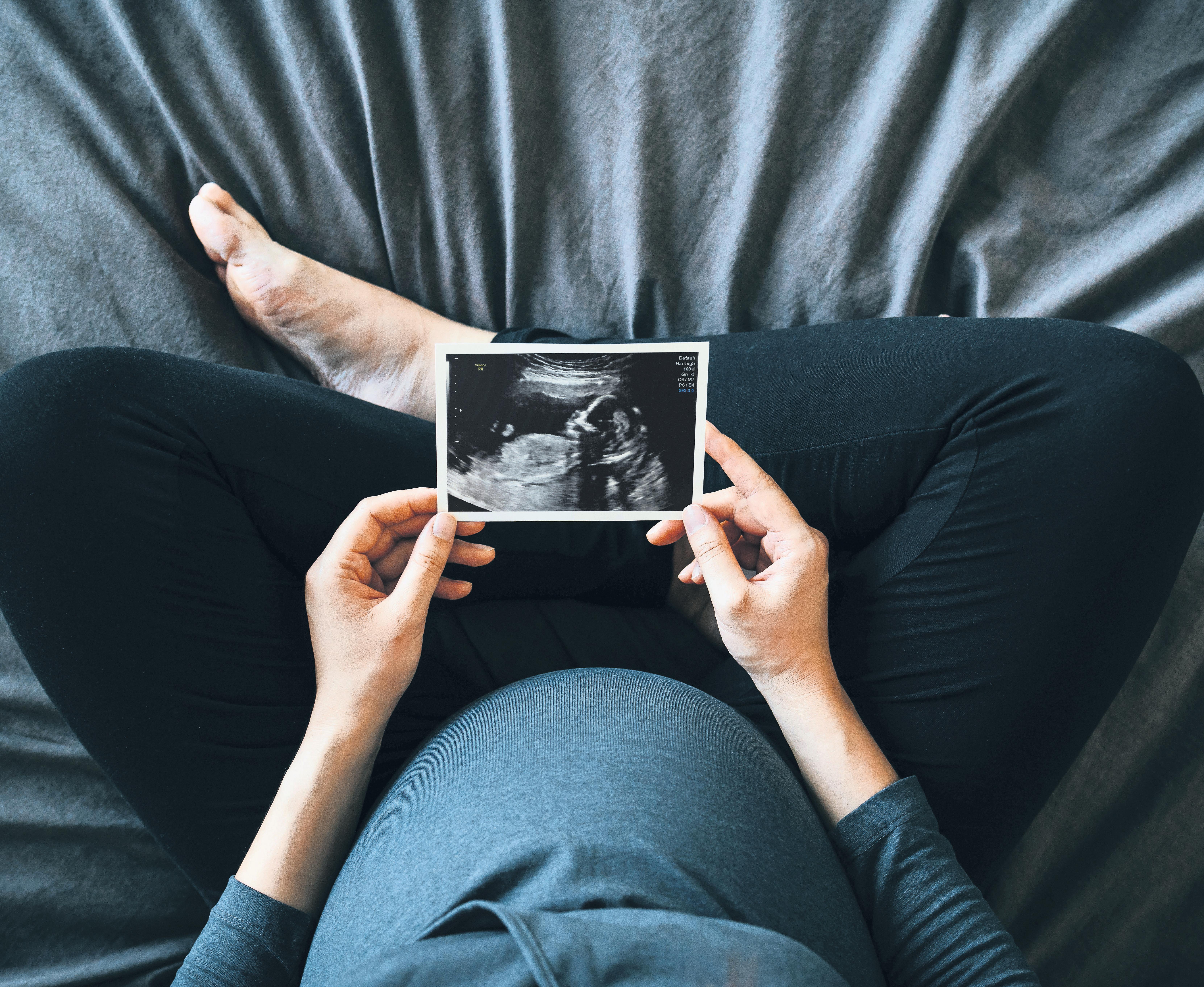Firms lose £53.8m a year by refusing fertility leave