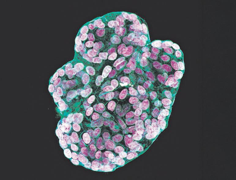 Mini-stomachs grown in lab to help us digest cancer data