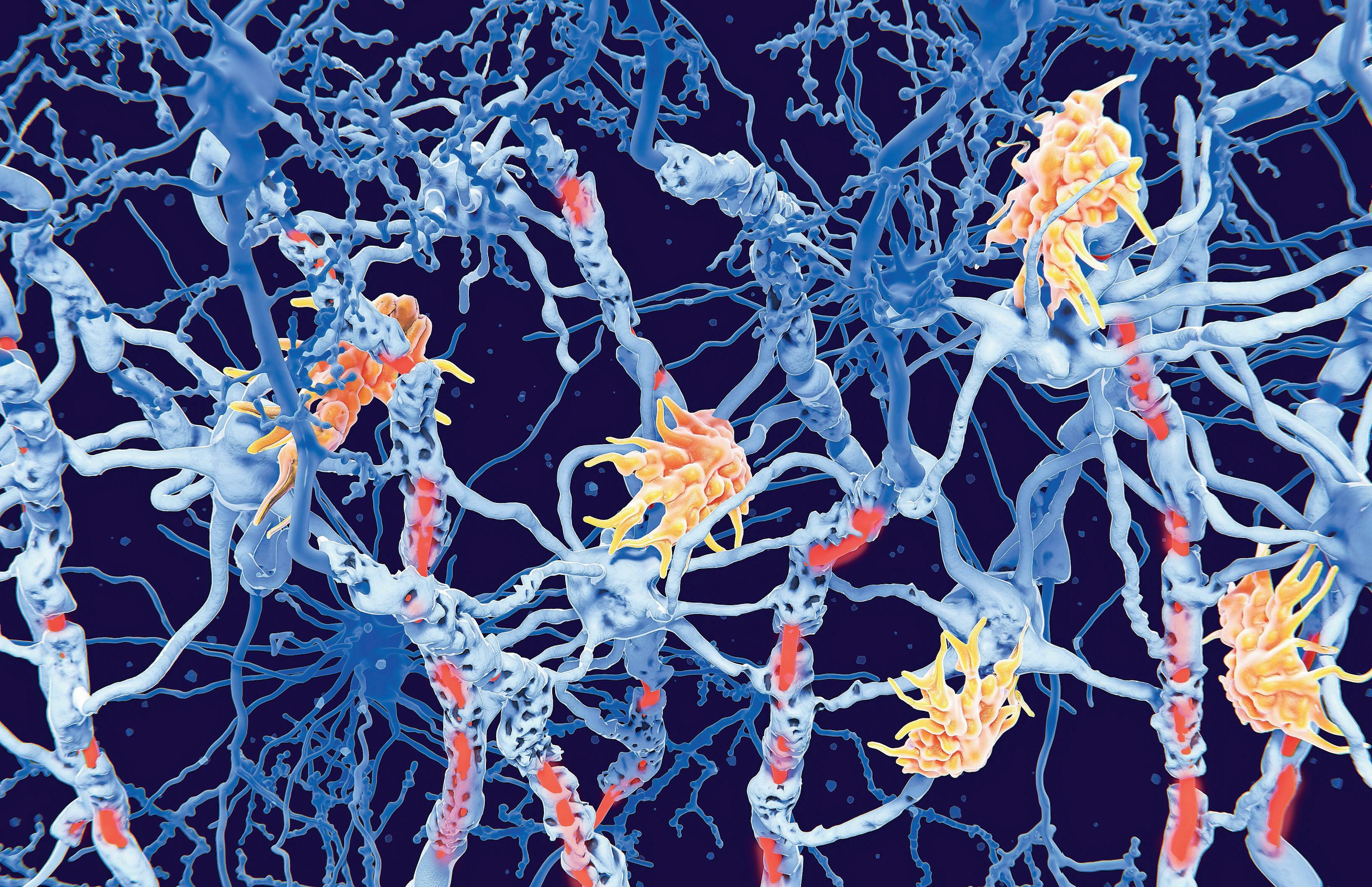 Inverse vaccines An advance against autoimmune disease?